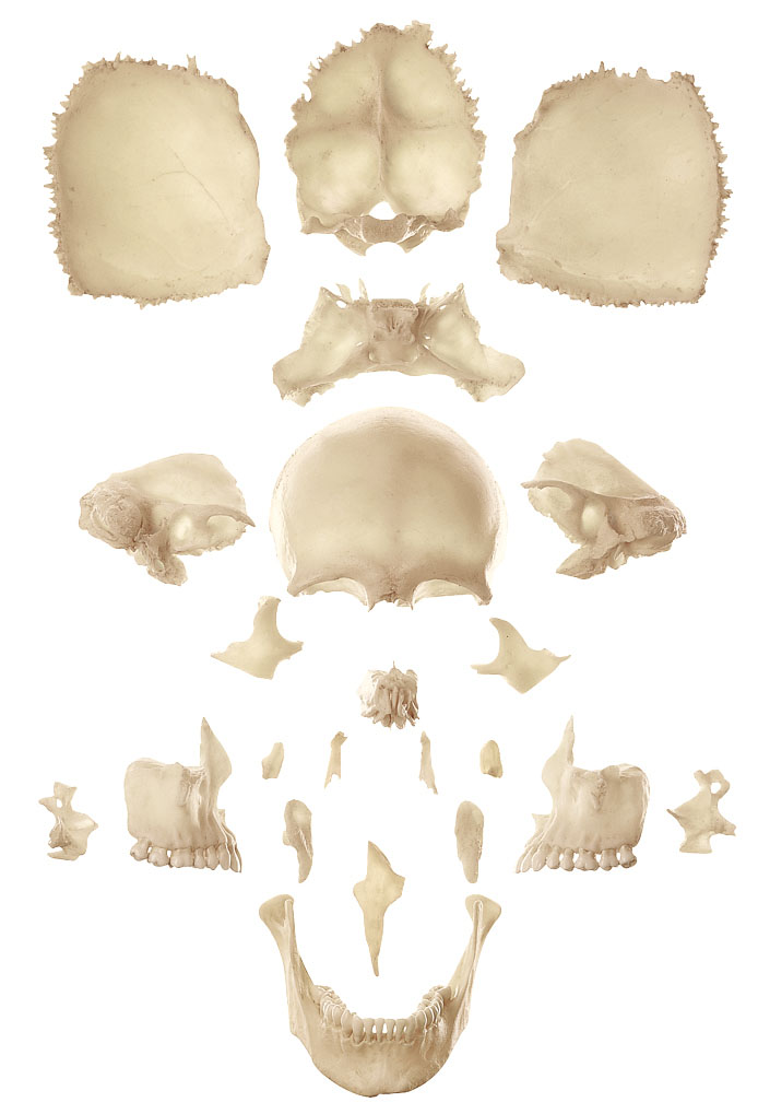 Artificial Bauchene Skull of an Adult (Unmounted)