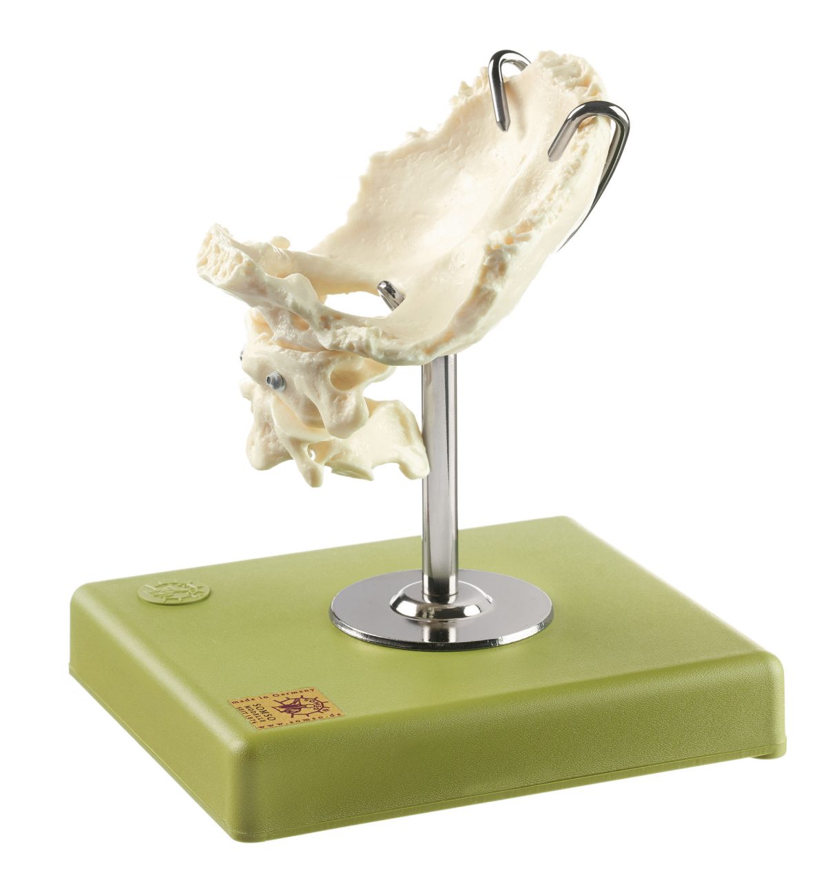 Atlas, Axis and Squamous Part of the Occipital Bone