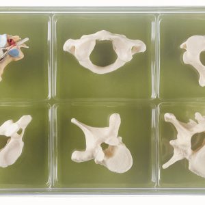 Collection Case "Vertebrae and Spinal Cord"