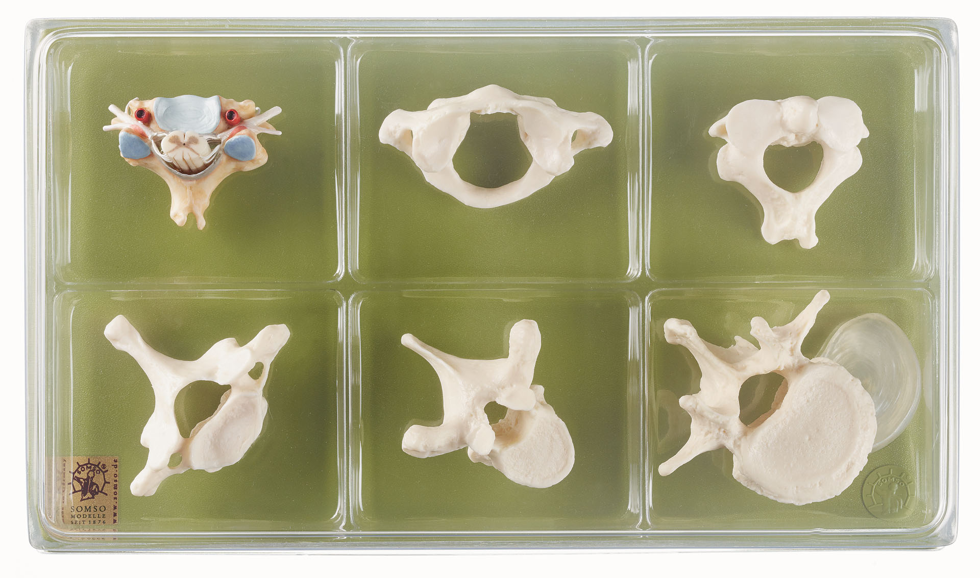 Collection Case “Vertebrae and Spinal Cord”