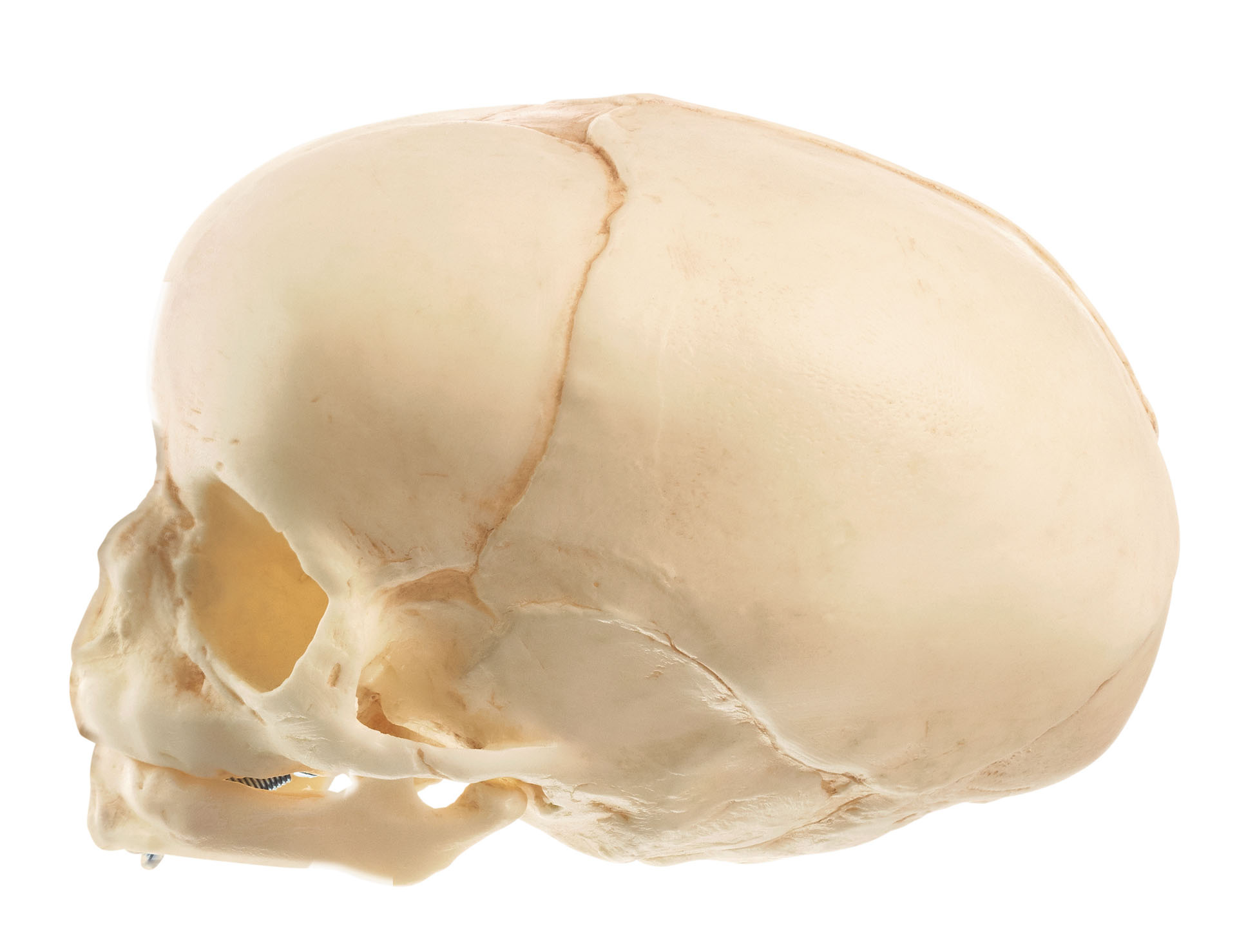 Artificial Skull of a Fetus