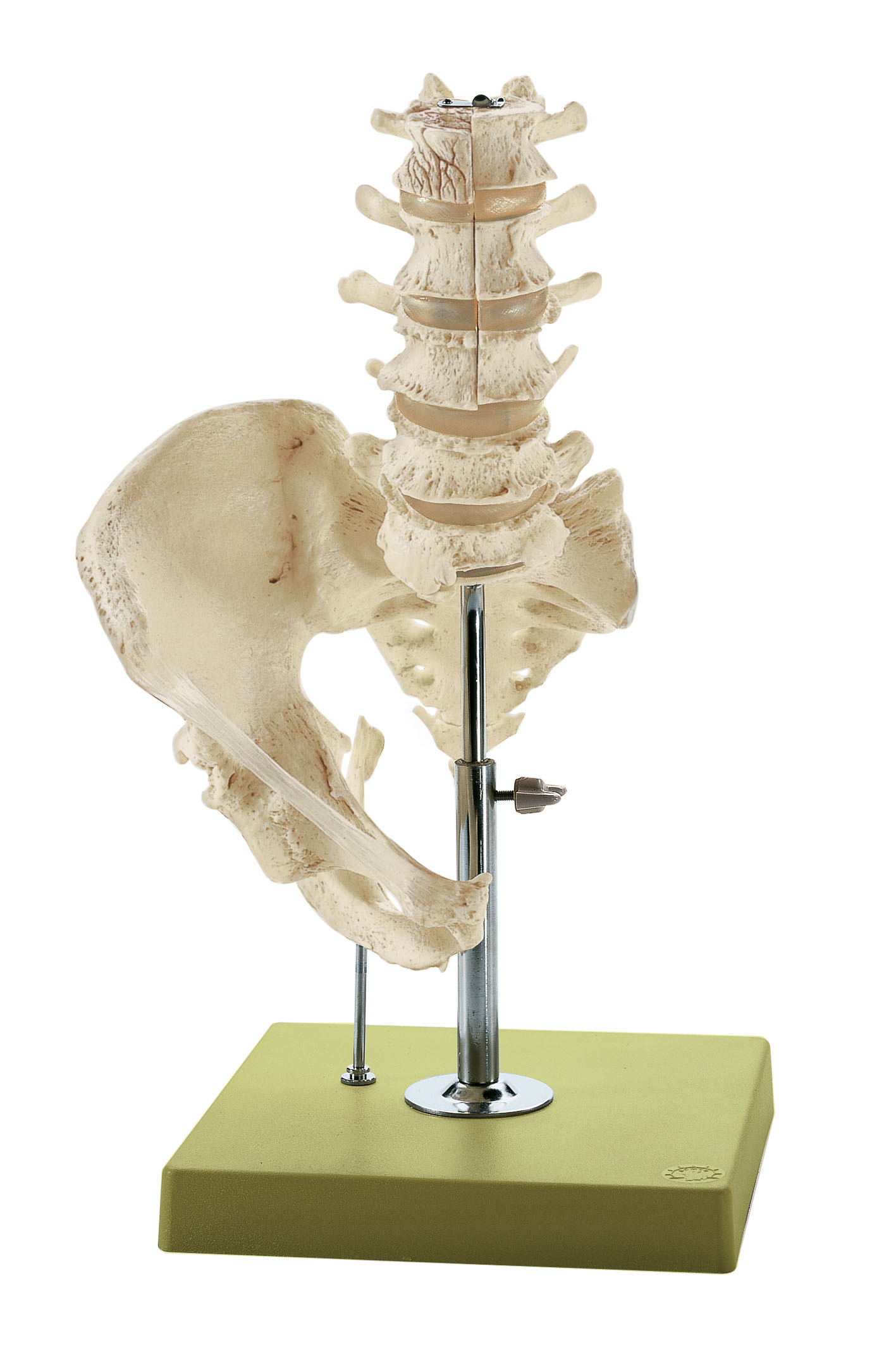 Lumbar Spinal Column – Without Innervation