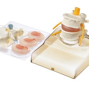 Intervertebral Disc Model