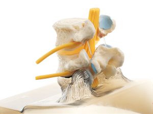 Intervertebral Disc Model