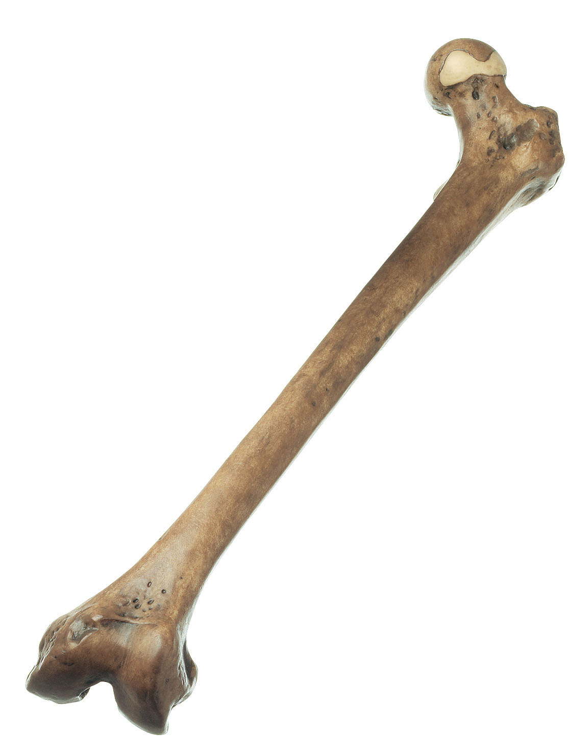 Reconstruction of a Thigh of Homo Erectus (Trinil 3)