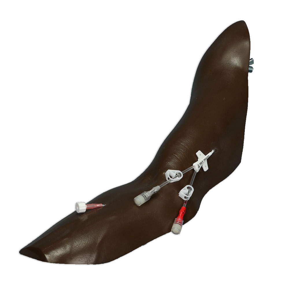 Replacement Standard Arm for Chester