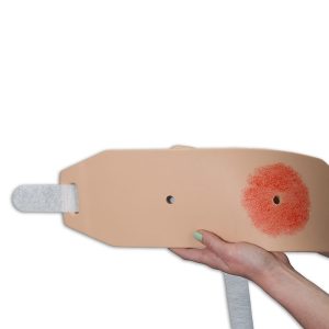 Ostomy Pouching Trainer™ Model, Light