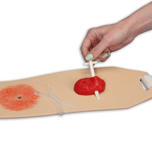 Ostomy Pouching Trainer™ Model, Light