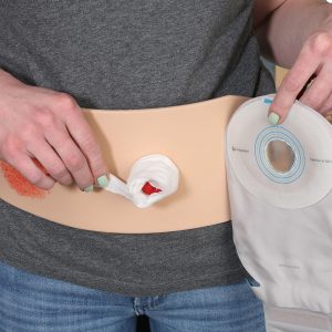 Ostomy Pouching Trainer™ Model, Light