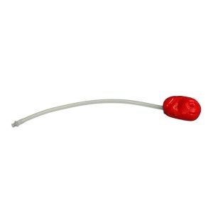 Replacement Loop Stoma