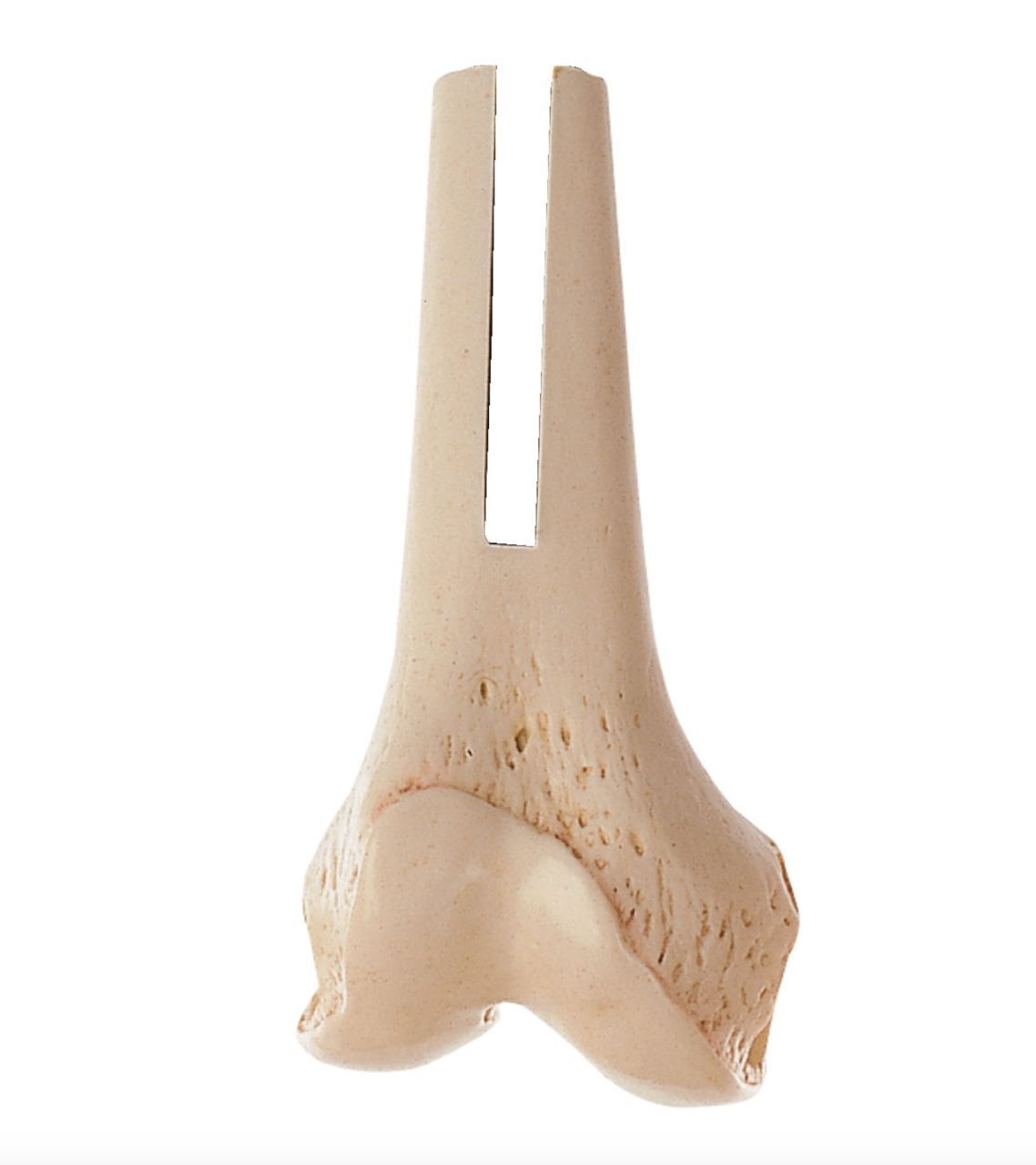 Thigh Bone