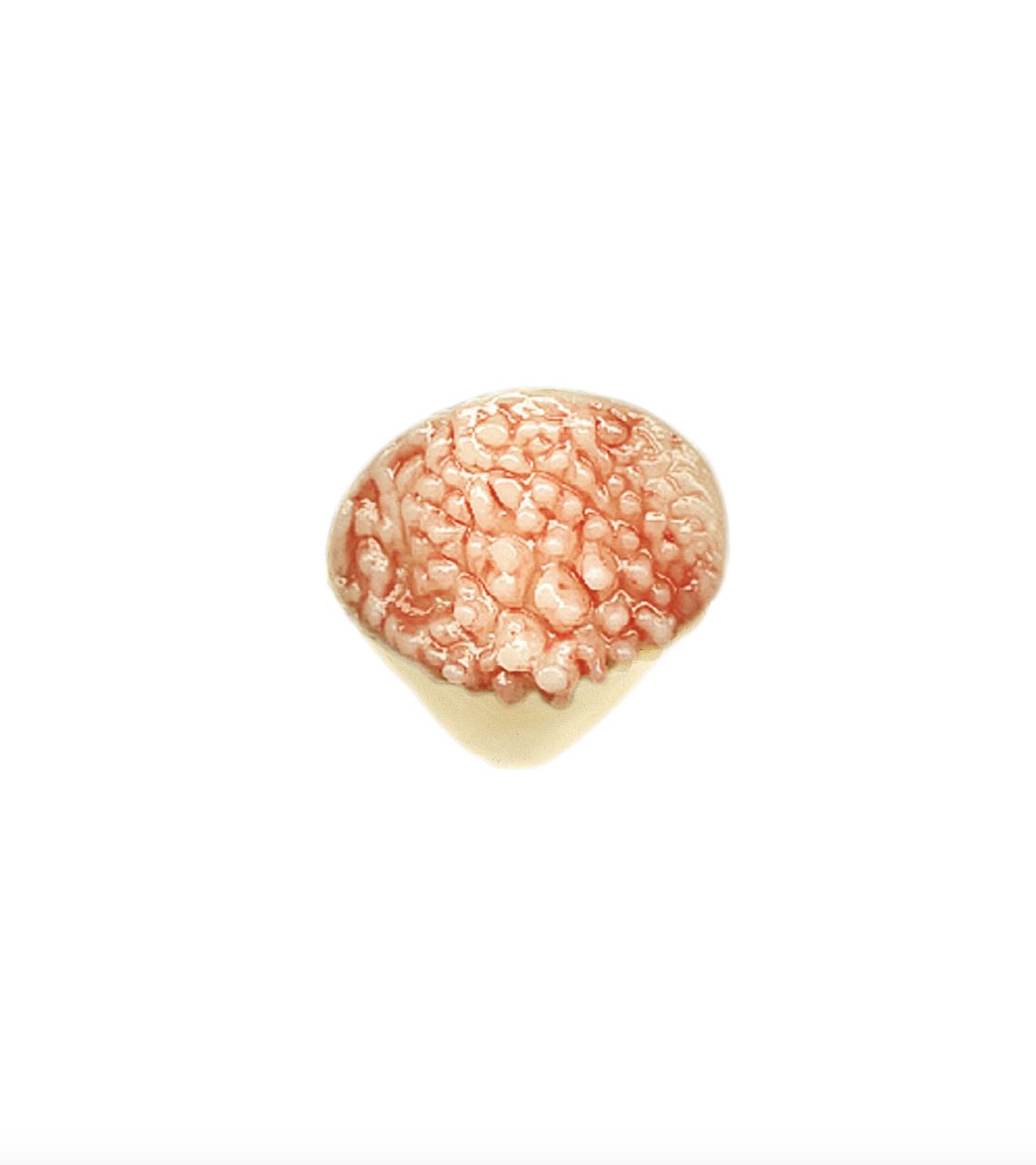Patella With Villus Formation