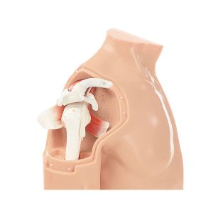Arthroscopy Model of the Shoulder
