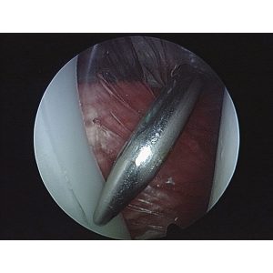 Arthroscopy Model of the Shoulder