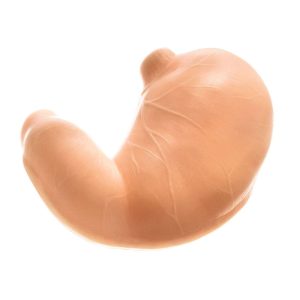 Stomach With Patent Connector for Connection to Esophagus