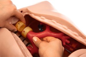 Intubation Phantom