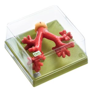 Healthy Bronchial Tree