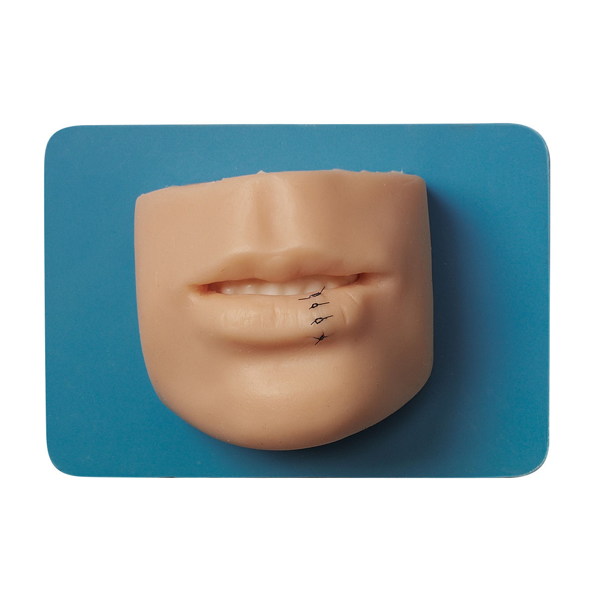 Facial Suturing Mouth Skin