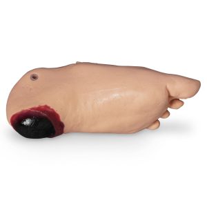 GERi/KERi Optional Edema Foot With Deep Tissue Injury, Light