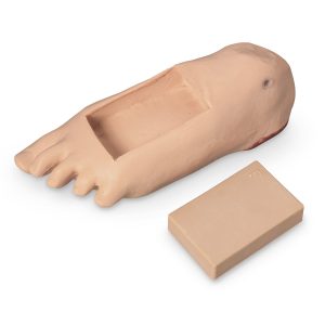 GERi/KERi Optional Edema Foot With Deep Tissue Injury, Light
