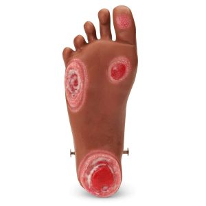 Geri™ and Keri™ Optional Pressure Injury Foot