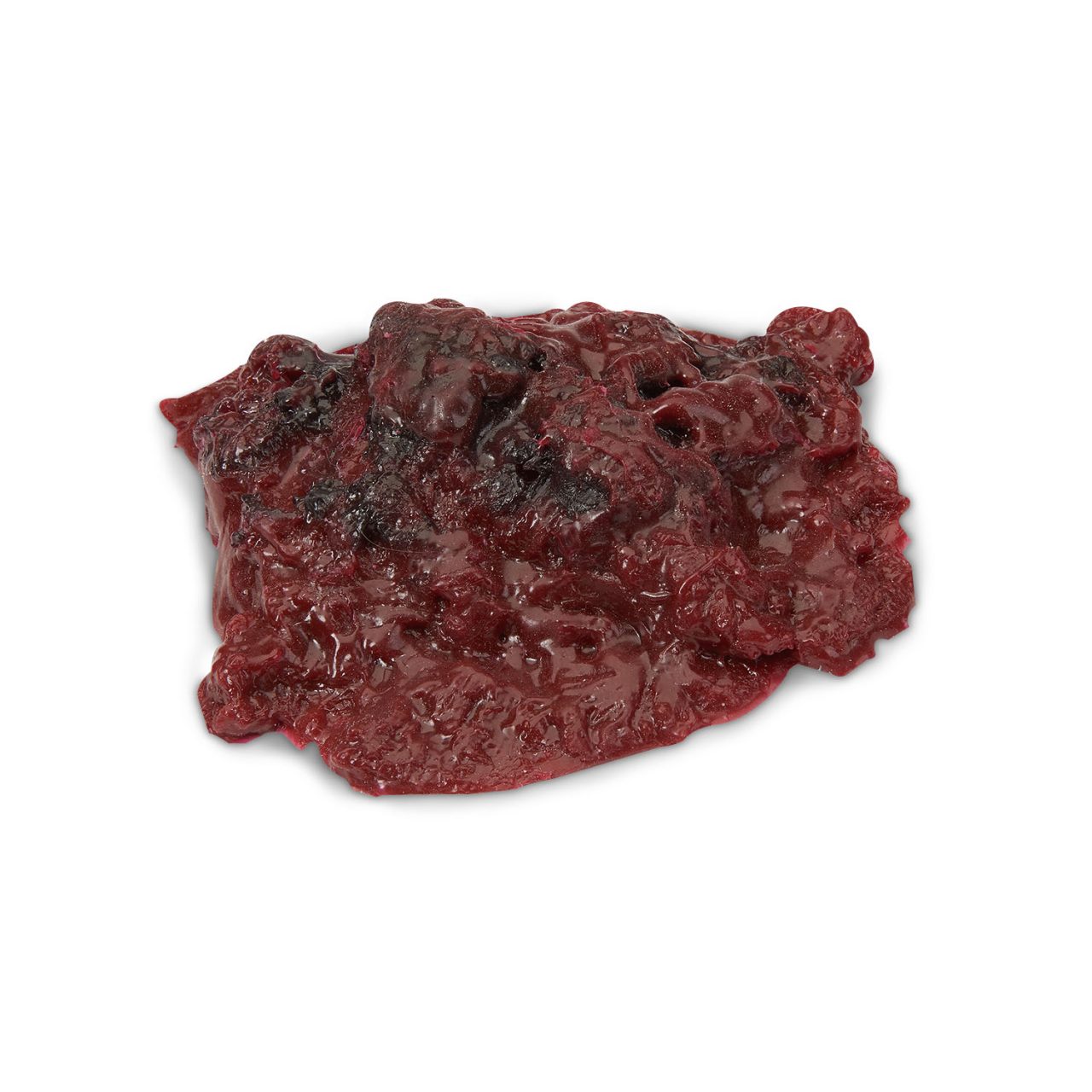 Small Blood Clot