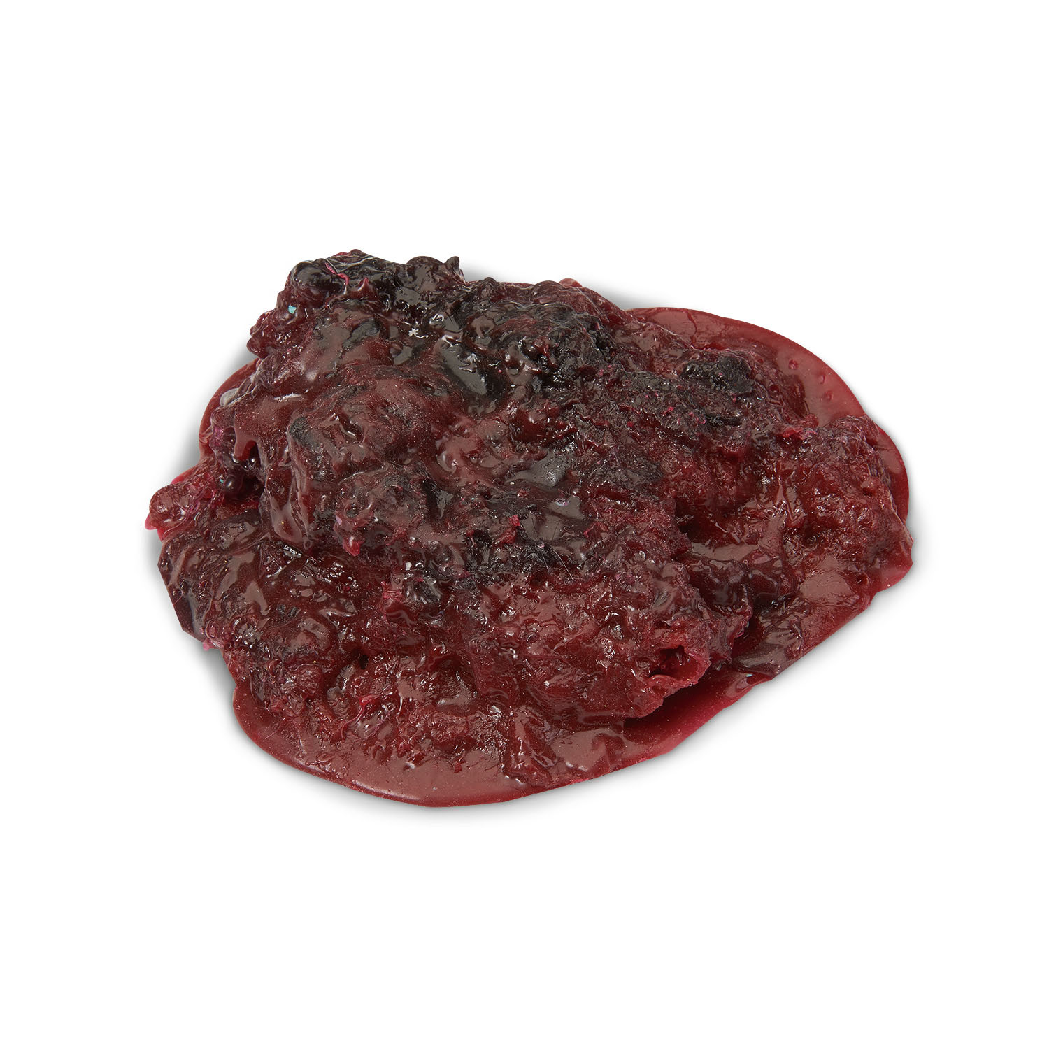 Large Blood Clot
