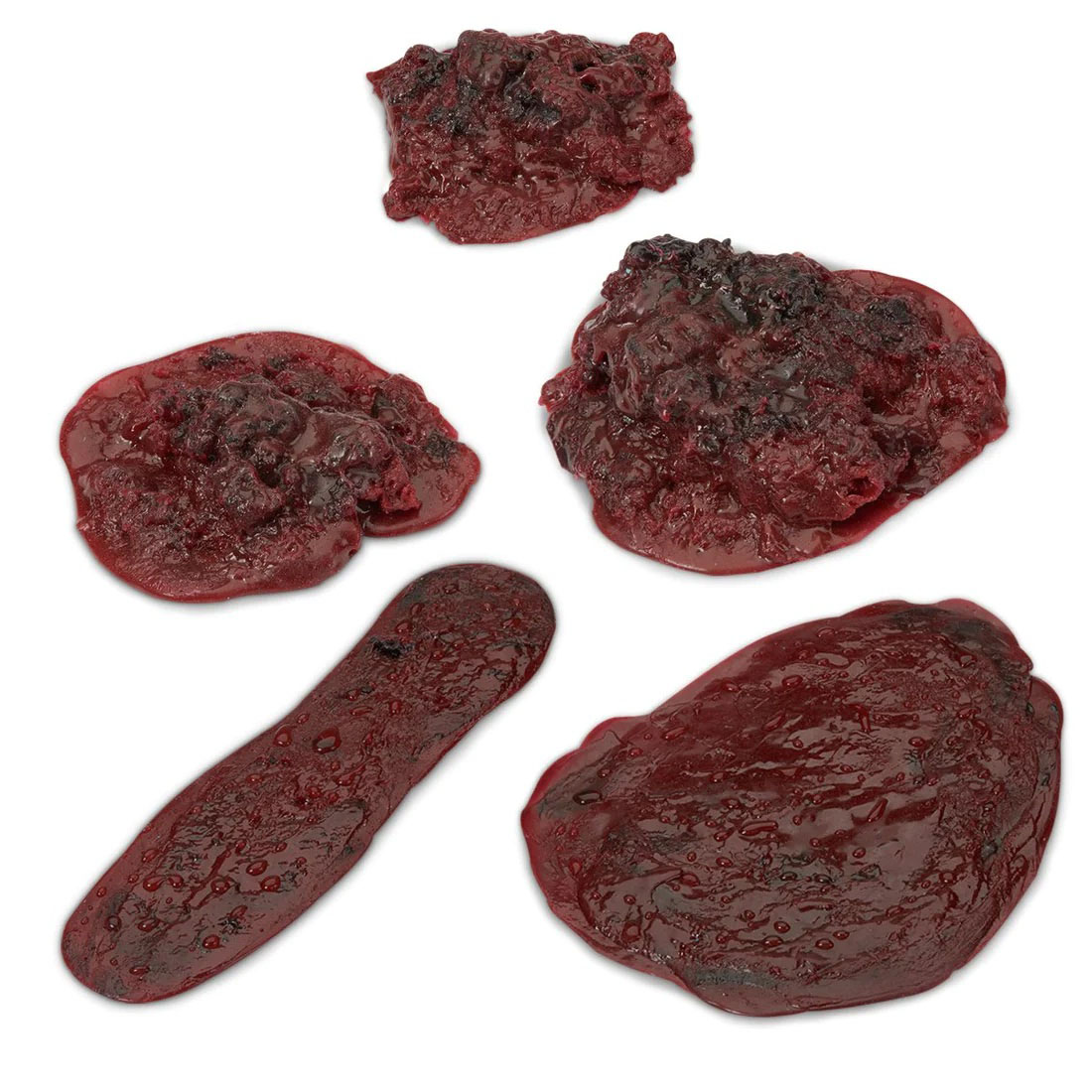 Clots and Haemorrhage Complete Set