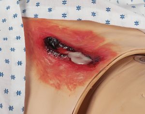 Ultra Nursing Wound Simulation Kit