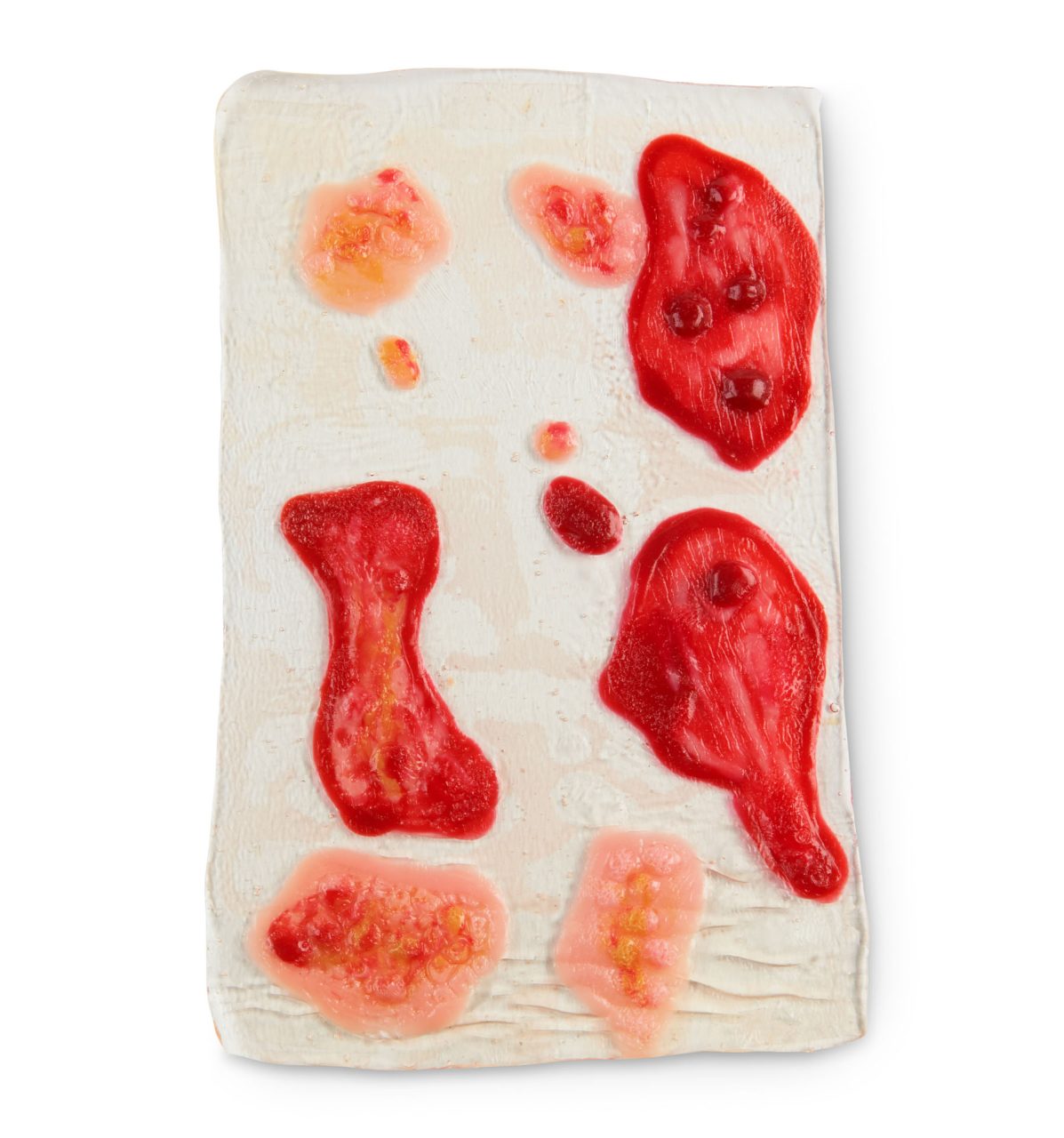 Shingles Rashes