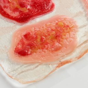 Shingles Rashes