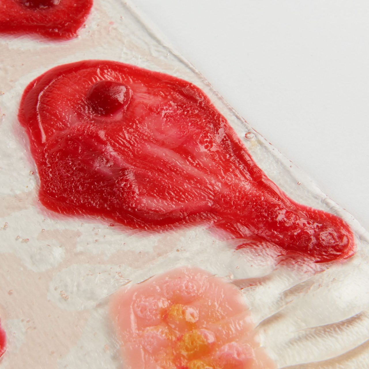 Shingles Rashes