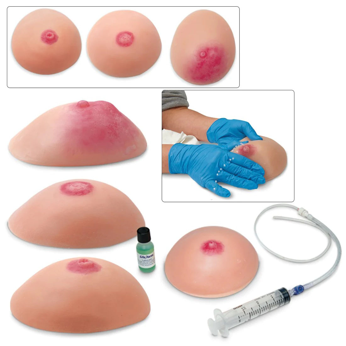 Common Breast Conditions (Set of 4)
