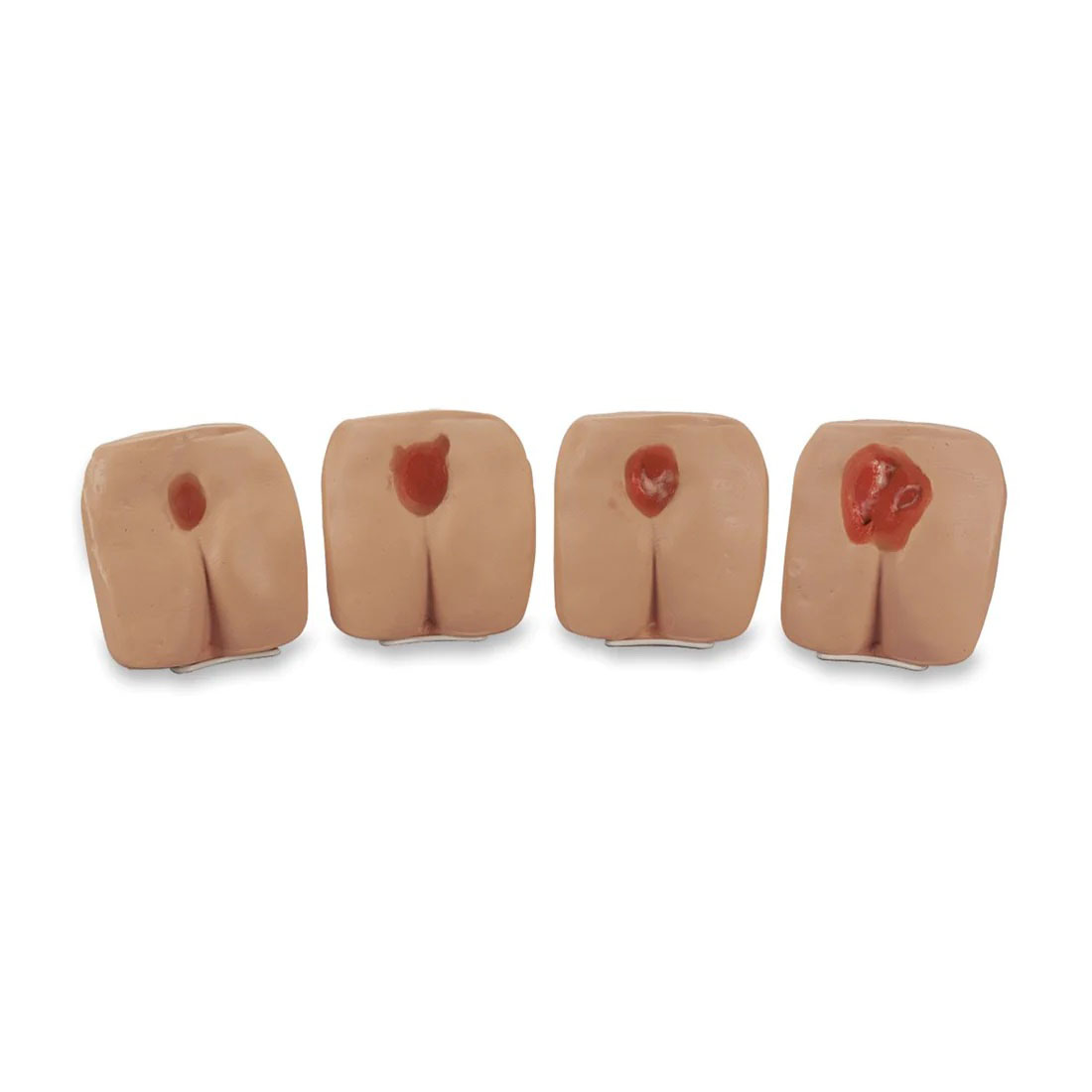 Pressure Ulcer/Bedsore Models, Light