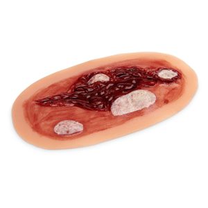 Nursing Care Wound Kit