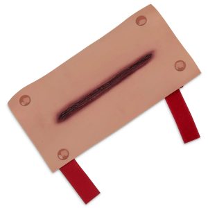 Laceration of the Forearm