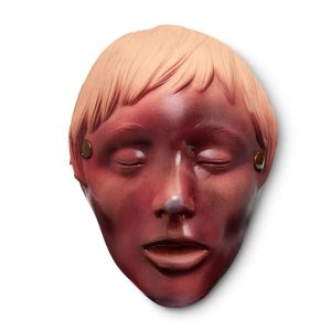 Burn of Face (for Manikin Use Only)