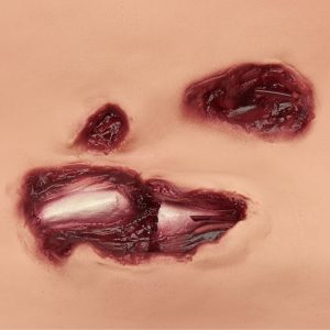 Basic Casualty Simulation Kit