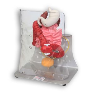 Otto Ostomy Model - Advanced