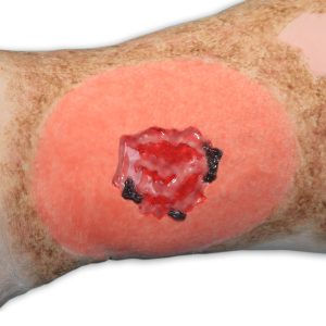 Vinnie Venous Insufficiency Leg™, Light