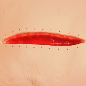 Seymour II Wound Care Model, Light