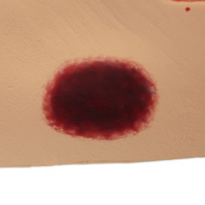 Seymour II Wound Care Model, Light