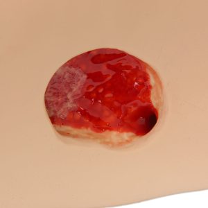 Seymour II Wound Care Model, Light