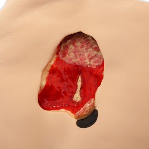 Seymour II Wound Care Model, Light
