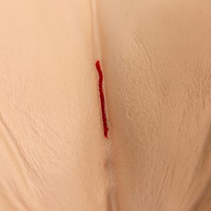 Seymour II Wound Care Model, Light