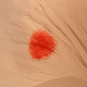 Seymour II Wound Care Model, Light