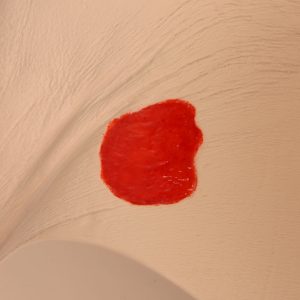 Seymour II Wound Care Model, Light