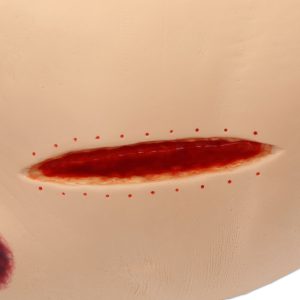 Seymour II Wound Care Model, Light