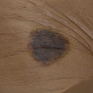 Seymour II Wound Care Model™, Dark
