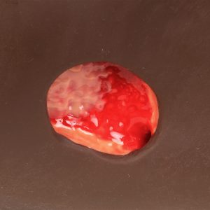 Seymour II Wound Care Model™, Dark
